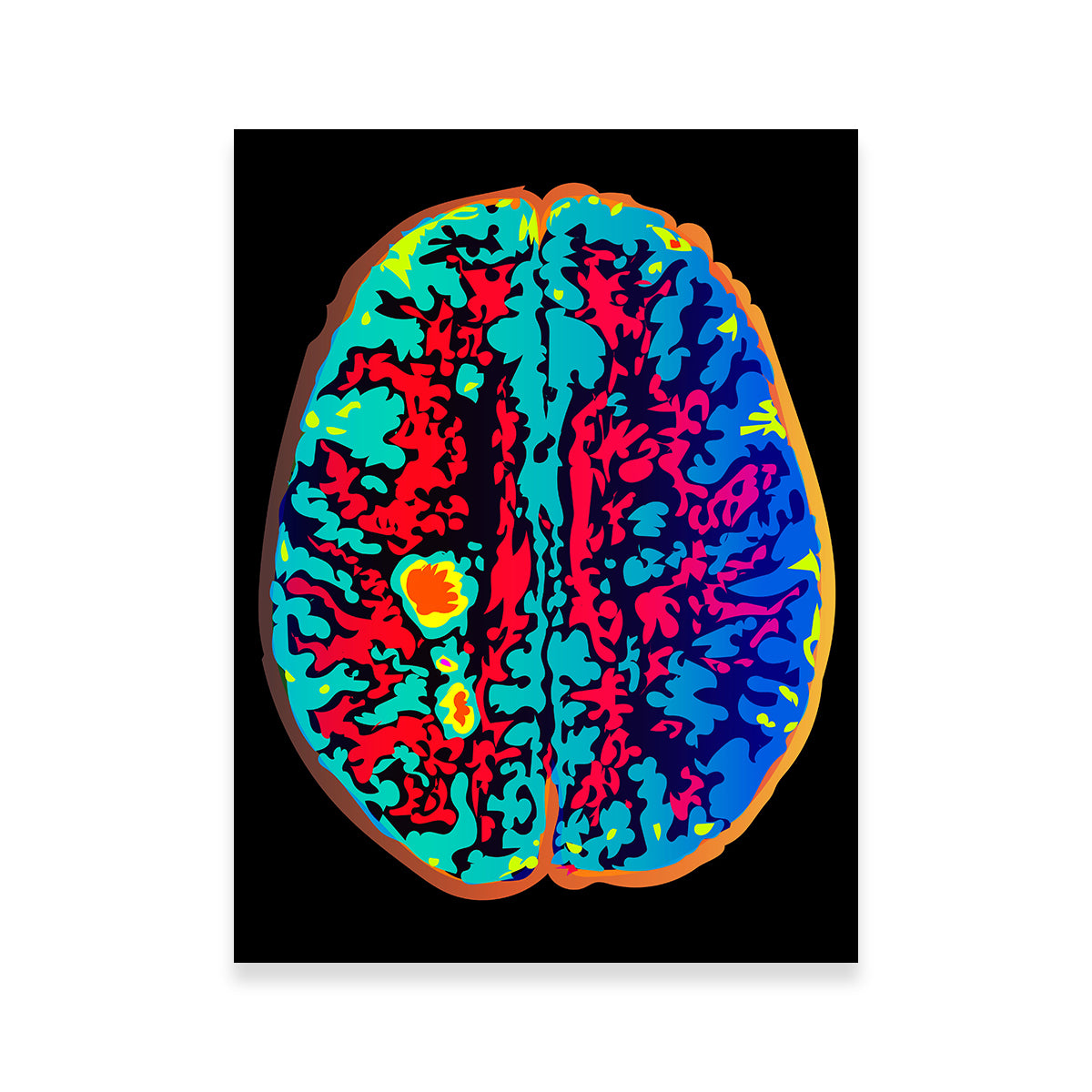 Brain Scan Wall Art
