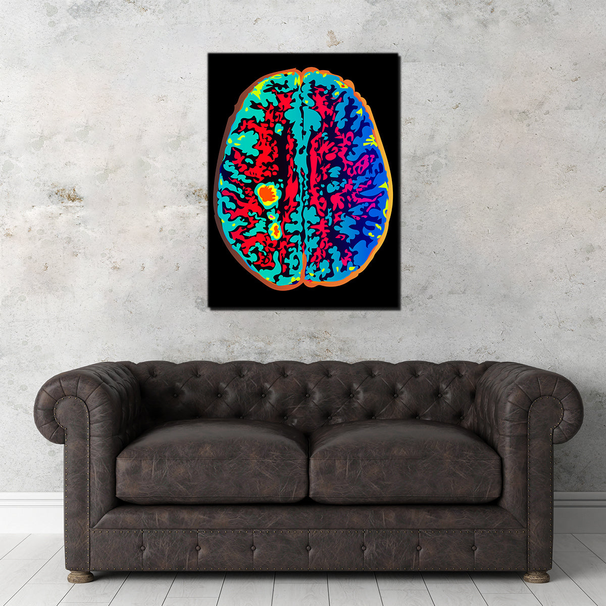 Brain Scan Wall Art