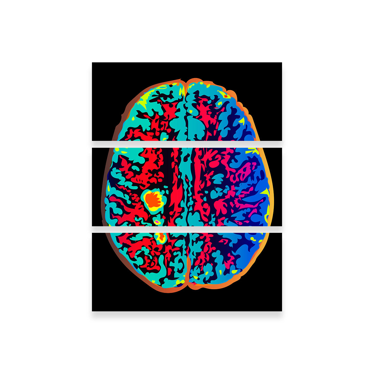 Brain Scan