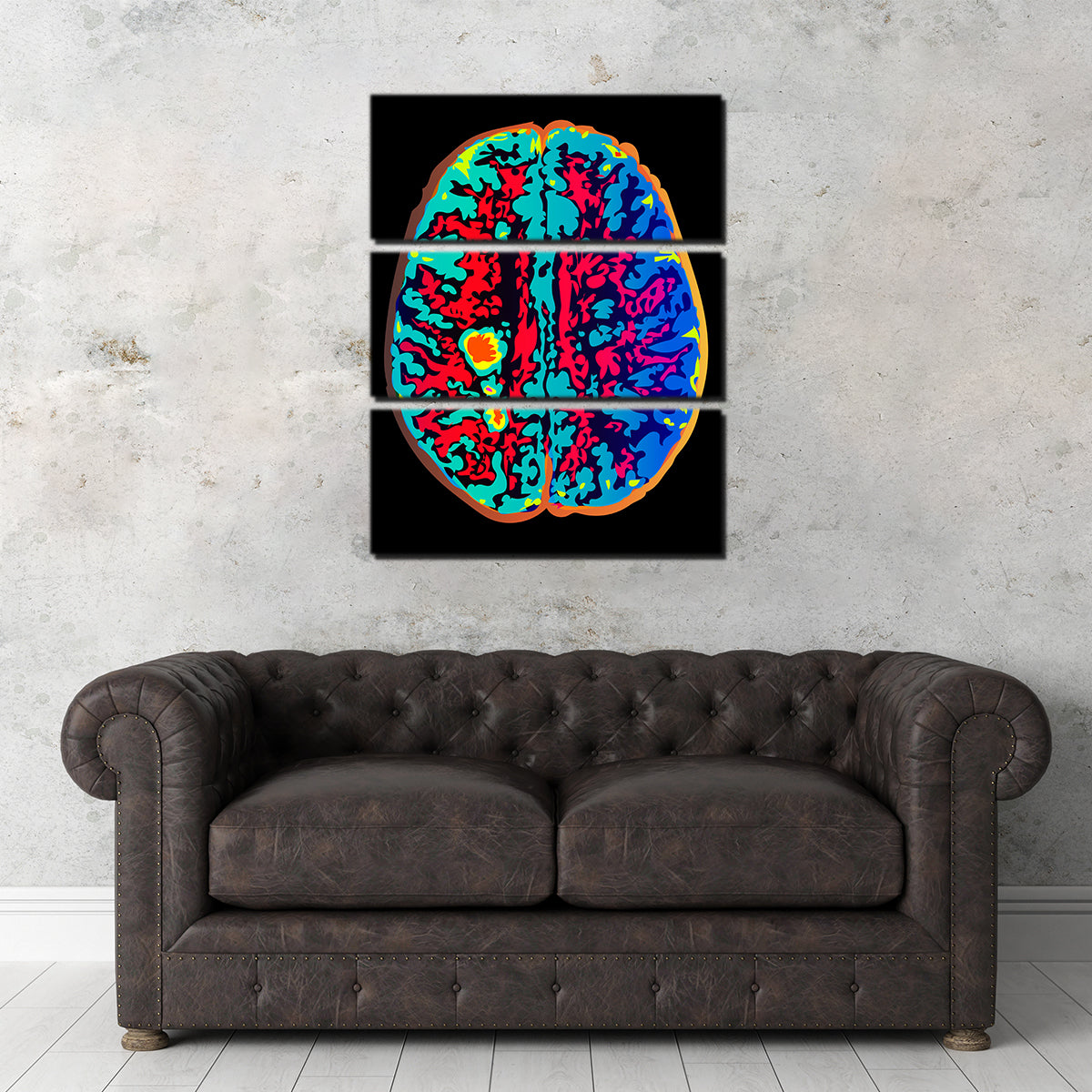 Brain Scan Wall Art