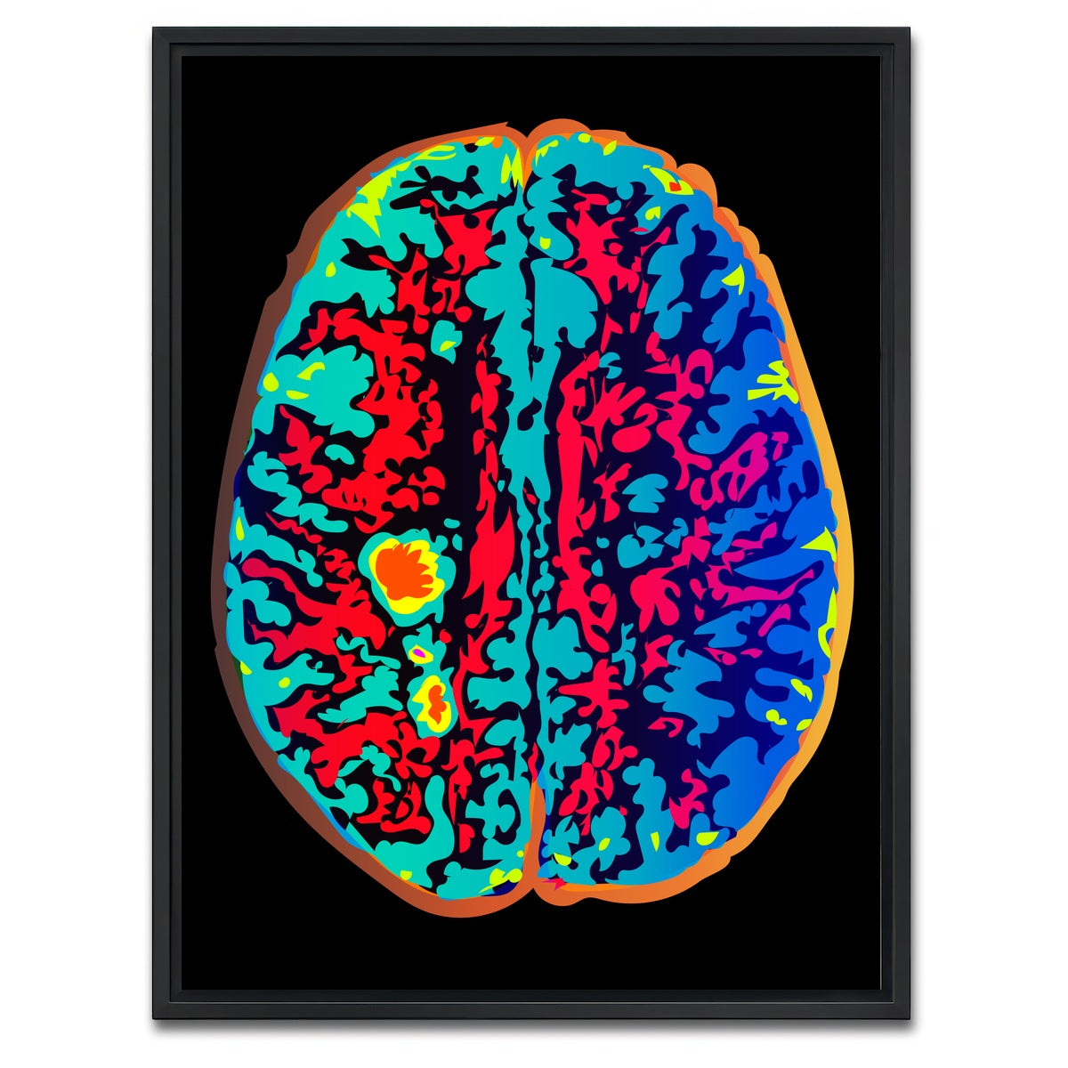 AUTO-MOCKUP WHITE | Brain Scan | 1 Piece | Black Framed Canvas | group=3x4