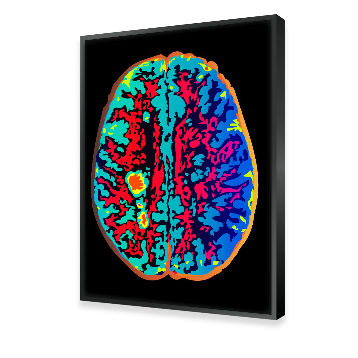Brain Scan Wall Art