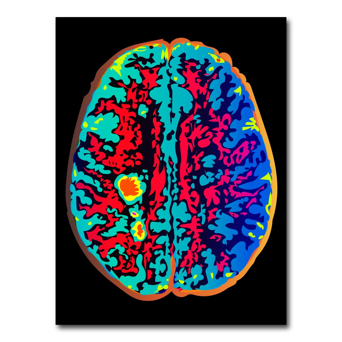 AUTO-MOCKUP WHITE | Brain Scan | 1 Piece | Gallery Wrap Canvas | group=3x4