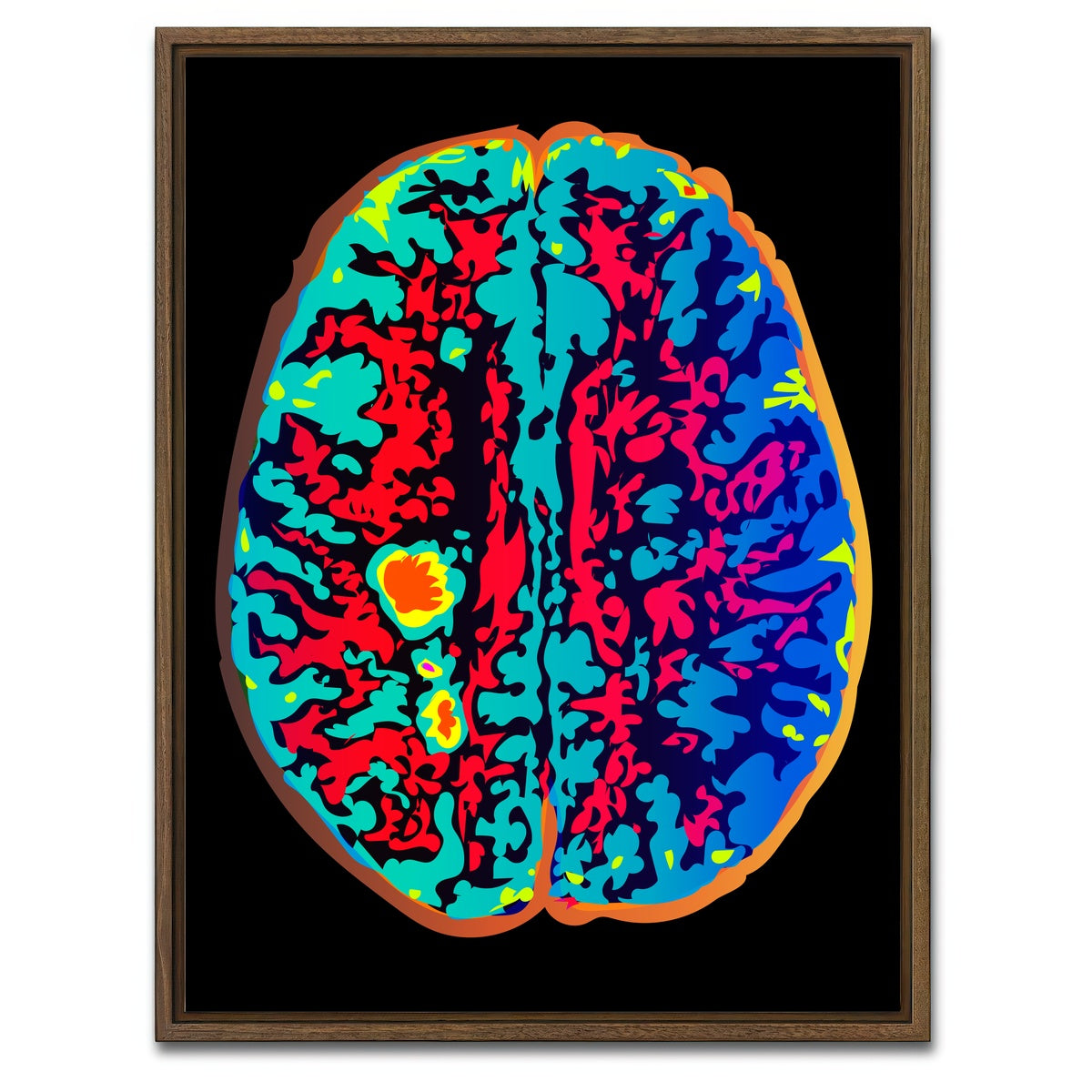 AUTO-MOCKUP WHITE | Brain Scan | 1 Piece | Walnut Framed Canvas | group=3x4