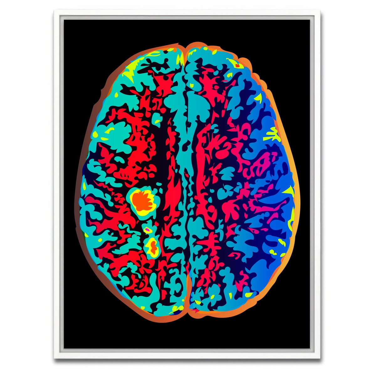 AUTO-MOCKUP WHITE | Brain Scan | 1 Piece | White Framed Canvas | group=3x4