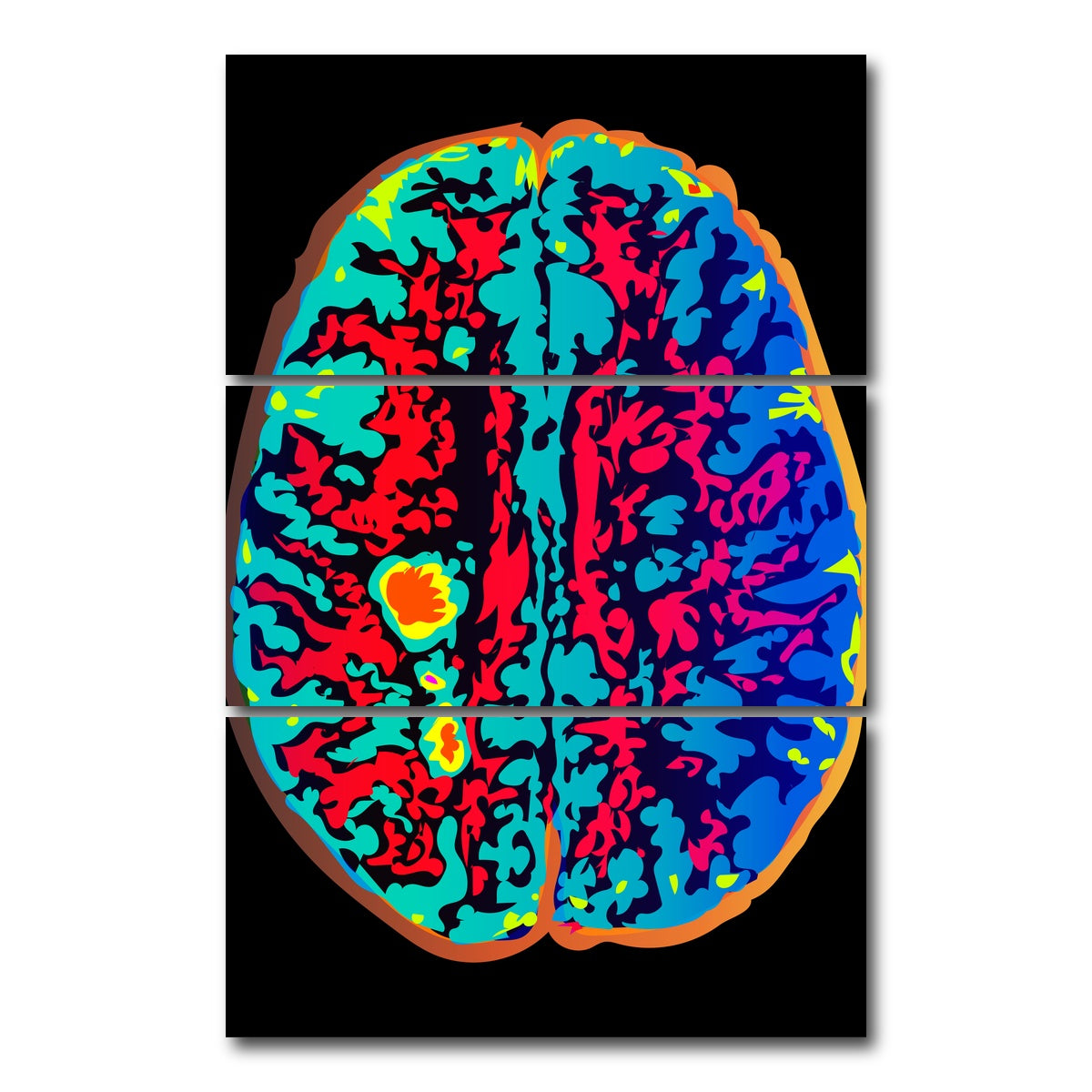 AUTO-MOCKUP WHITE | Brain Scan | 3 Piece | Gallery Wrap Canvas | group=12x24_stacked