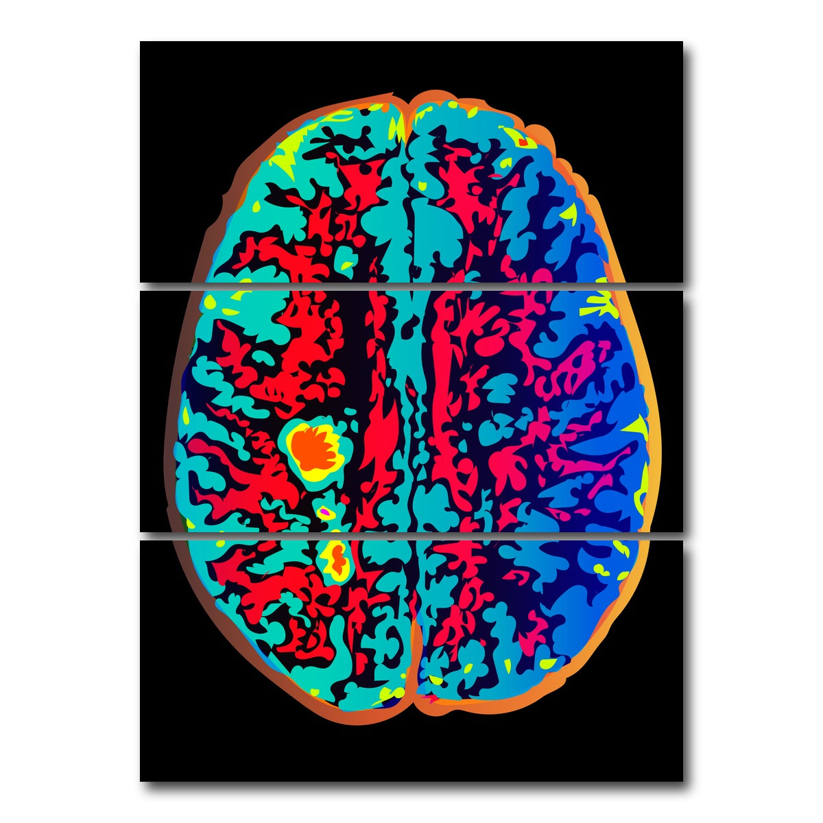 AUTO-MOCKUP WHITE | Brain Scan | 3 Piece | Gallery Wrap Canvas | group=8x18_stacked