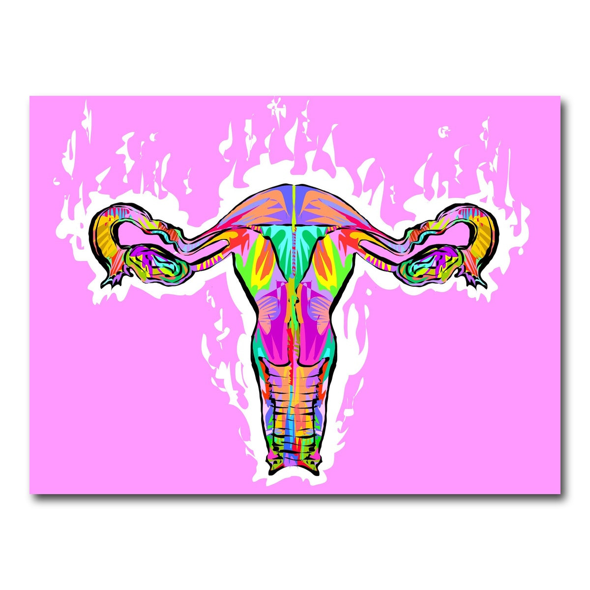 AUTO-MOCKUP WHITE | OVARIES | 1 Piece | Gallery Wrap Canvas | group=4x3